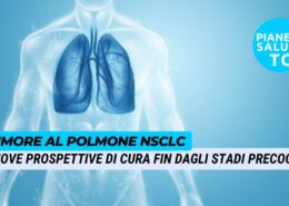 Approvato atezolizumab per tumore al polmone NSCLC riduce il rischio di recidiva o di morte del 57%