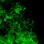 Centri Antiveleni, SITOX: Necessarie nuove risorse strutturali e umane. Urgente l’implementazione delle attività all’interno dei LEP - tossicologia