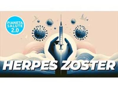 Herpes-Zoster
