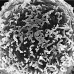 Sclerosi Multipla: uno studio immunologico svela come le vescicole extracellulari - piccolissime entità biologiche - mostrano un grande potenziale nella malattia
