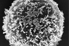 Sclerosi Multipla: uno studio immunologico svela come le vescicole extracellulari – piccolissime entità biologiche – mostrano un grande potenziale nella malattia