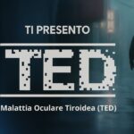 Ti presento TED: la malattia oculare tiroidea che cambia lo sguardo (e la vita)