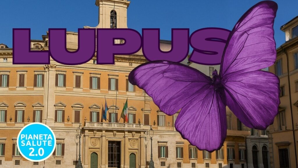 Lupus eritematoso sistemico