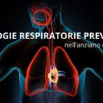 Virus respiratorio sinciziale