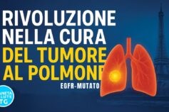 Tumore al polmone EGFR mutato: una terapia senza chemio migliora la sopravvivenza globale