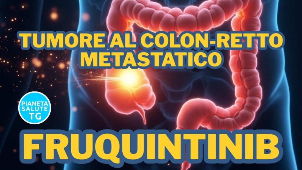 Tumore al colon retto metastatico: arriva in Italia Fruquintinib, un nuovo farmaco che migliora la sopravvivenza 1 Tumore al colon retto metastatico: arriva in Italia Fruquintinib, un nuovo farmaco che migliora la sopravvivenza