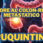Tumore al colon retto metastatico: arriva in Italia Fruquintinib, un nuovo farmaco che migliora la sopravvivenza