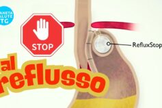 Reflusso gastroesofageo: la rivoluzione mini-invasiva che cambia la vita ai pazienti