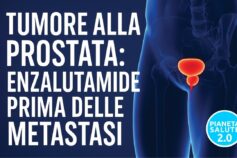 Una svolta nella cura del tumore alla prostata