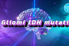 Nuove terapie per i gliomi IDH mutati: una speranza per i tumori cerebrali rari