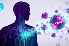 Terapia CAR-T Axi-cel: la nuova frontiera contro il linfoma aggressivo