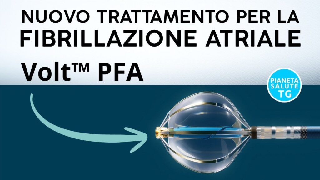 Fibrillazione atriale