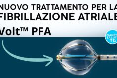 Fibrillazione atriale: arriva Volt PFA, la nuova ablazione senza calore che riduce i rischi e accelera le procedure