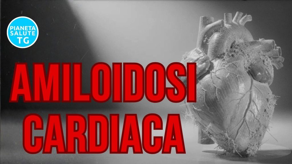 Amiloidosi cardiaca