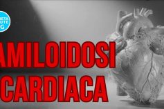 Amiloidosi cardiaca: verso un modello nazionale di diagnosi precoce e presa in carico equa