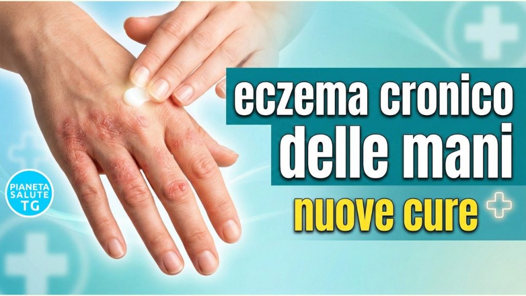Eczema cronico delle mani: le nuove frontiere terapeutiche per una patologia invalidante